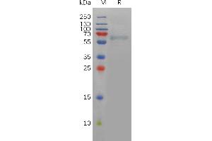 Human FURIN Protein, His Tag on SDS-PAGE under reducing condition.