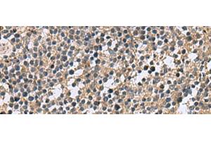 Immunohistochemistry of paraffin-embedded Human tonsil tissue using CSRP2 Polyclonal Antibody at dilution of 1:60(x200) (CSRP2 Antikörper)