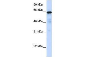 Western Blot showing FOXN4 antibody used at a concentration of 1-2 ug/ml to detect its target protein.