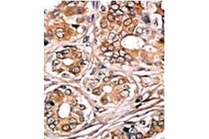 Image no. 1 for anti-Retinoblastoma 1 (RB1) (pSer780) antibody (ABIN358213) (Retinoblastoma 1 Antikörper  (pSer780))