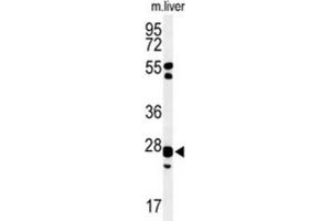 Western Blotting (WB) image for anti-Glutathione S-Transferase kappa 1 (GSTK1) antibody (ABIN3004354) (GSTK1 Antikörper)