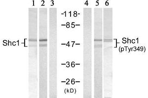 Western blot analysis of extracts from 293 cells, using Shc1 (Ab-349) Antibody (E021316, Lane 1, 2 and 3) and Shc1 (Phospho-Tyr349) Antibody (E011316, Lane 4, 5 and 6). (SHC1 Antikörper)