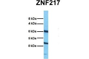 Host:  Rabbit  Target Name:  ZNF217  Sample Tissue:  Human HepG2  Antibody Dilution:  1.