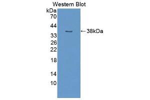 Western blot analysis of the recombinant protein. (NUP50 Antikörper  (AA 134-393))