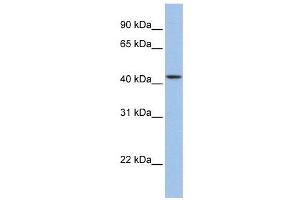 WB Suggested Anti-ZNF202  Antibody Titration: 0. (ZNF202 Antikörper  (Middle Region))