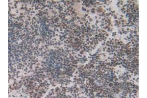 IHC-P analysis of Mouse Spleen Tissue, with DAB staining. (IRF2 Antikörper  (AA 1-349))