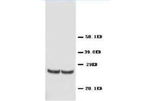 Western blot analysis of rat kidney tissue lysis using TIMP4 antibody (TIMP4 Antikörper  (C-Term))