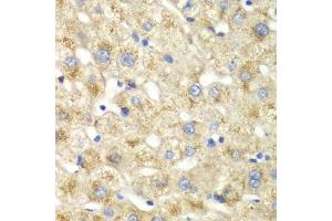 Immunohistochemistry of paraffin-embedded human liver injury using CALD1 antibody. (Caldesmon Antikörper  (AA 1-240))