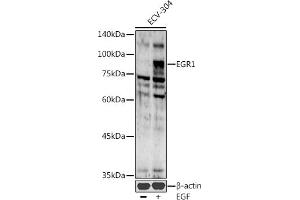 Western blot analysis of extracts of ECV-304 cells, using EGR1 antibody (ABIN6133683, ABIN6139992, ABIN7101807 and ABIN7101808) at 1:1000 dilution.