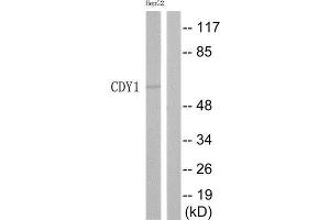 Western Blotting (WB) image for anti-Chromodomain Protein, Y-Linked, 1 (CDY1) (Internal Region) antibody (ABIN1852531) (CDY1 Antikörper  (Internal Region))