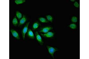 Immunofluorescent analysis of A549 cells using ABIN7143732 at dilution of 1:100 and Alexa Fluor 488-congugated AffiniPure Goat Anti-Rabbit IgG(H+L) (AAGAB Antikörper  (AA 191-315))