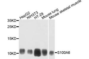Western blot analysis of extracts of various cell lines, using S100A6 antibody. (S100A6 Antikörper)