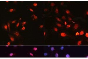 Immunofluorescence analysis of U2OS cells using Phospho-γH2A. (gamma H2AX Antikörper  (pSer139))