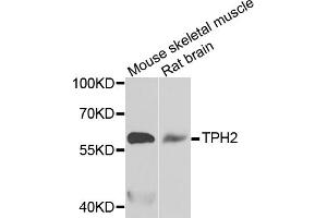 Western blot analysis of extracts of various cell lines, using TPH2 antibody (ABIN5974298) at 1/1000 dilution. (Tryptophan Hydroxylase 2 Antikörper)