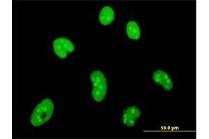 Immunofluorescence of monoclonal antibody to HMGB1 on HeLa cell. (HMGB1 Antikörper  (AA 1-215))
