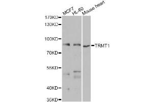 Western blot analysis of extracts of various cell lines, using TRMT1 antibody (ABIN2560567) at 1:1000 dilution. (TRMT1 Antikörper)
