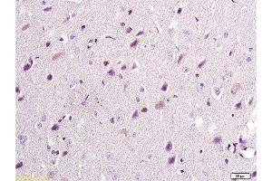 Formalin-fixed and paraffin embedded: rat brain tissue labeled with Anti-NR2B/NMDAR2B Polyclonal Antibody, Unconjugated  at 1:300, followed by conjugation to the secondary antibody and DAB staining (GRIN2B Antikörper  (AA 451-550))