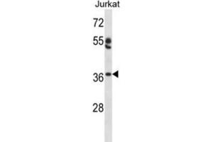 Western Blotting (WB) image for anti-Ovo-Like 1 (OVOL1) antibody (ABIN2998129) (OVOL1 Antikörper)