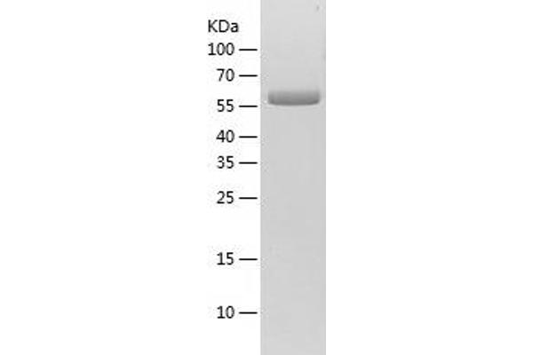 PLBD2 Protein (AA 47-594) (His-IF2DI Tag)