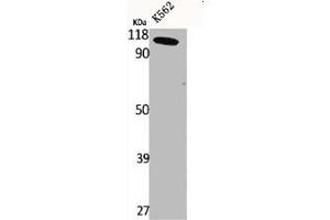Western Blot analysis of K562 cells using CLC-6 Polyclonal Antibody (CLCN6 Antikörper  (Internal Region))