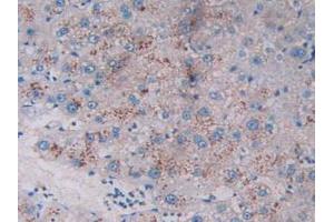 Figure. (TPSAB1 Antikörper  (AA 161-262))