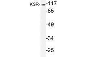 Western blot analysis of KSR antibody in extracts from NIH/3T3 cells. (KSR1 Antikörper)