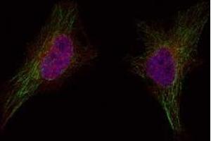 Image no. 1 for anti-Breast Cancer 1 (BRCA1) (Ser1524) antibody (ABIN401620) (BRCA1 Antikörper  (Ser1524))