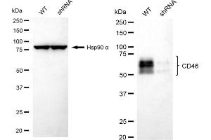 Western blotting analysis using CD46 antibody (ABIN7797974). (Rekombinanter CD46 Antikörper)