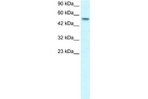 WB Suggested Anti-RUNX1T1 Antibody Titration:  1. (RUNX1T1 Antikörper  (Middle Region))