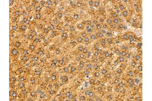 ABIN6258514 and ABIN6274732 at 1/100 staining Rat liver tissue by IHC-P. (MRPL16 Antikörper  (Internal Region))
