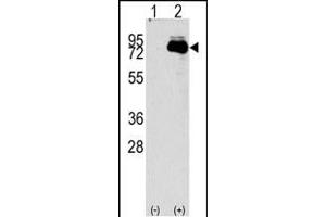 Western blot analysis of NUAK2 (arrow) using rabbit polyclonal NUAK2 Antibody (N-term) (R). (NUAK2 Antikörper  (N-Term))
