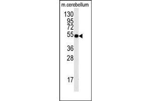 Image no. 1 for anti-Cell Division Cycle 25 Homolog A (S. Pombe) (CDC25A) (Ser78) antibody (ABIN358772) (CDC25A Antikörper  (Ser78))