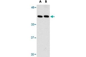 Western blot analysis of PTER in human kidney tissue lysate with PTER polyclonal antibody  at (A) 1 and (B) 2 ug/mL . (PTER Antikörper  (C-Term))