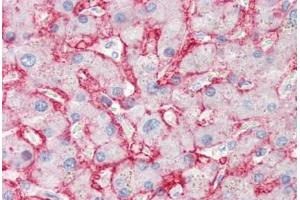 Human Liver (formalin-fixed, paraffin-embedded) stained with SLC2A2 antibody ABIN337148 at 10 ug/ml followed by biotinylated anti-mouse IgG secondary antibody ABIN481714, alkaline phosphatase-streptavidin and chromogen. (SLC2A2 Antikörper)