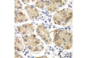 Immunohistochemistry of paraffin-embedded human normal stomach using CHIT1 antibody at dilution of 1:200 (400x lens). (Chitotriosidase 1 Antikörper)