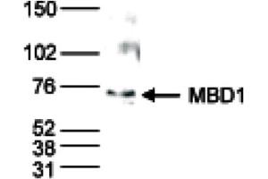 Western Blot results of Rabbit anti-MBD1 antibody Western Blot results of Rabbit anti-MBD1 antibody.