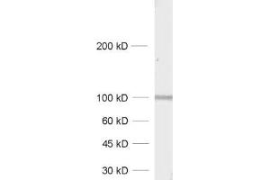 dilution: 1 : 1000, sample: synaptic membrane fraction of rat brain (LP1) (GRIA4 Antikörper  (AA 850-902))
