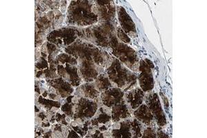 Immunohistochemical staining of human stomach with CDCA7 polyclonal antibody  shows strong cytoplasmic positivity in granular pattern in glandular cells at 1:200-1:500 dilution. (CDCA7 Antikörper)
