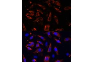 Immunofluorescence analysis of U-2OS cells using MCTS1 antibody (ABIN6132341, ABIN6143657, ABIN6143658 and ABIN6224877) at dilution of 1:100 (40x lens). (MCTS1 Antikörper  (AA 1-181))