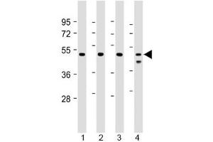 Western blot testing of human 1) Jurkat, 2) U-2 0S, 3) HeLa and 4) MCF7 cell lysate with PSMC2 antibody at 1:2000. (PSMC2 Antikörper)