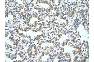 Rabbit Anti-ATG4B Antibody       Paraffin Embedded Tissue:  Human alveolar cell   Cellular Data:  Epithelial cells of renal tubule  Antibody Concentration:   4. (ATG4B Antikörper  (C-Term))