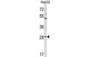 Western Blotting (WB) image for anti-Coiled-Coil Domain Containing 85B (CCDC85B) antibody (ABIN3004037) (CCDC85B Antikörper)