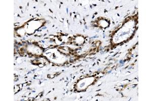IHC analysis of NOLA1/GAR1 using anti-NOLA1/GAR1 antibody (ABIN7602076). (GAR1 Antikörper  (AA 58-165))