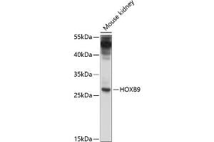 Western blot analysis of extracts of mouse kidney, using HOXB9 antibody  at 1:1000 dilution. (HOXB9 Antikörper  (AA 1-80))