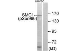 Western blot analysis of extracts from HuvEc cells treated with etoposide 24uM 24h, using SMC1 (Phospho-Ser966) Antibody. (SMC1A Antikörper  (pSer966))
