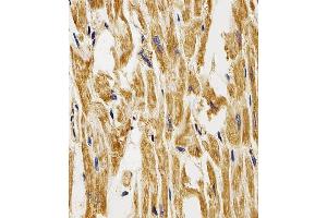 Immunohistochemistry (Paraffin-embedded Sections) (IHC (p)) image for anti-Fatty Acid Binding Protein 3, Muscle and Heart (FABP3) (AA 1-133) antibody (ABIN6242886)
