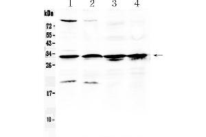 Western blot analysis of RPS6 using anti- RPS6 antibody . (RPS6 Antikörper  (N-Term))