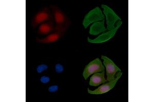 ABIN6264199 and ABIN6268876 staining Hela cells(30 min of UV treatment) by IF/ICC. (PIAS4 Antikörper  (C-Term))