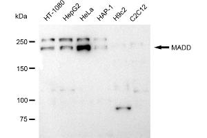 Western blotting analysis using MADD antibody (ABIN7799332).