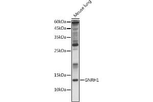 Western blot analysis of extracts of Rat kidney, using GNRH1 antibody (ABIN6131875, ABIN6141257, ABIN6141258 and ABIN6221260) at 1:1000 dilution.
